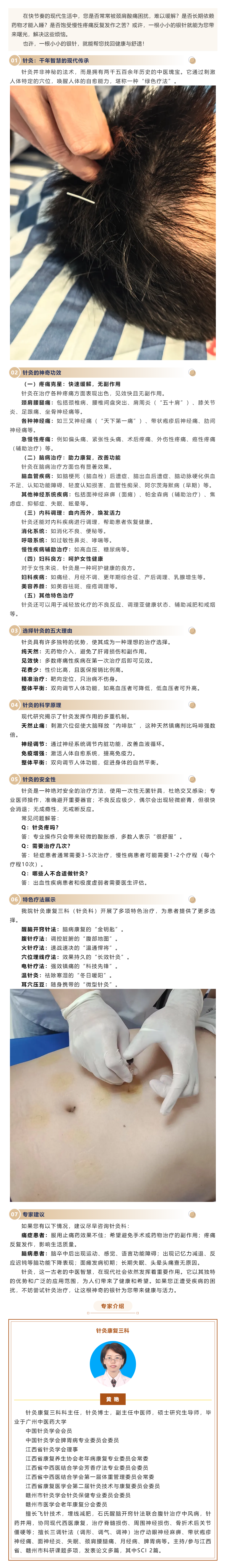 一根銀針，能治這么多病？中醫針灸的現代妙用.png